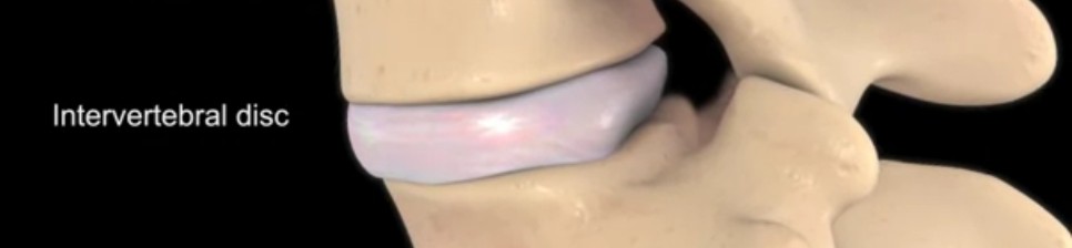 EPITROCHOID MOVEMENT AROUND INTERVERTEBRAL DISK