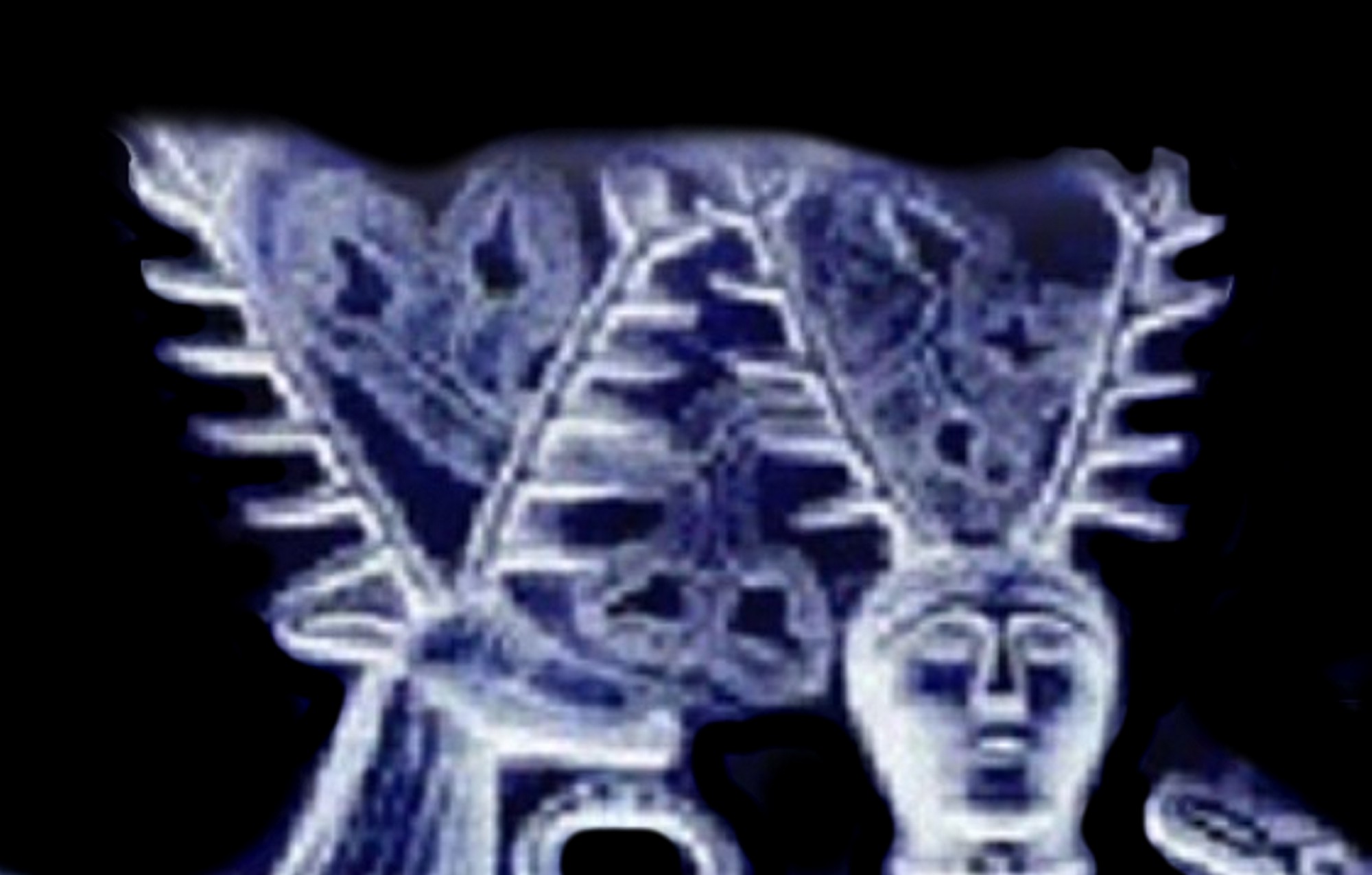YOGA_VORTEX_IZNAD_GLAVE _JELENA_COVJEKA_NEGATIVE1_3000.jpg (212207 bytes)