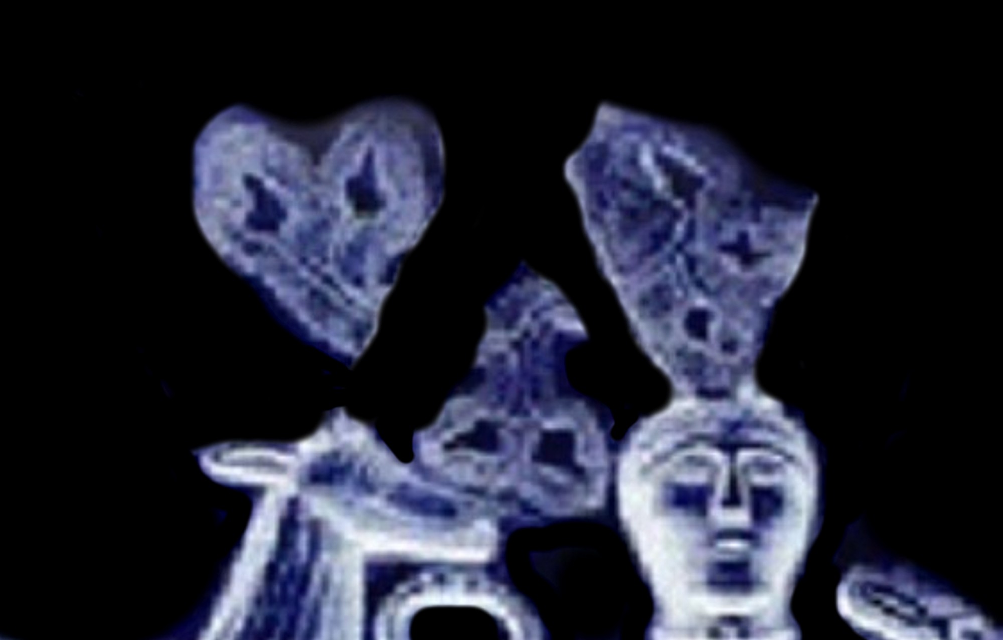 YOGA_VORTEX_IZNAD_GLAVE _JELENA_COVJEKA_NEGATIVE2_3000.jpg (158520 bytes)