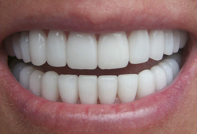TEETHES AS MAGNETIC PRINCIPLE - ZUBI KAO MAGNETNI PRINCIP.